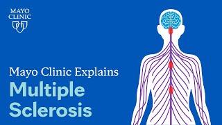 Mayo Clinic Explains Multiple Sclerosis [upl. by Rihsab]