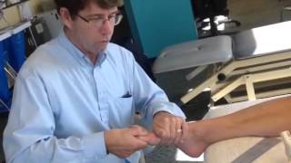 Hallux Limitus Evaluation with Self Mobilization [upl. by Becca]