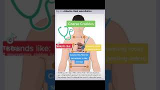 Chest Auscultation Identifying common BreathLung Sounds [upl. by Gardia]