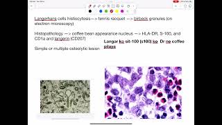 Langerhans cell histiocytosis mnemonics [upl. by Pavia]