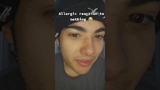 Im allergic to everything allergies story storytime entertainment duet funny comedyvideo [upl. by Monroy]