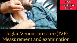 JVP Jugluar Venous Pulse Examination and measurement  CVS examination part 6 [upl. by Oys]