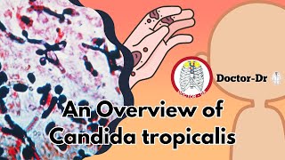 Candida tropicalis Understanding the Basics of a Common Fungal Infection  Mycology Lectures [upl. by Introk]