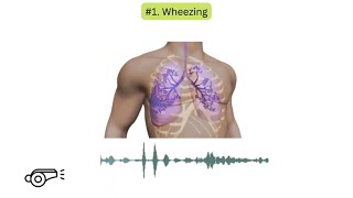 Abnormal lung sounds in COPD [upl. by Bonner]