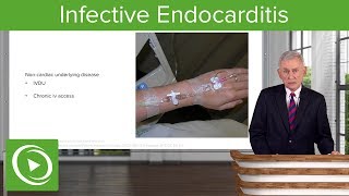 Infective Endocarditis IE Definition amp Epidemiology– Infectious Diseases  Lecturio [upl. by Arihay]