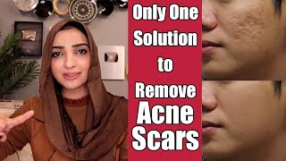 REMOVE FACE SCARS ACNE SPOTS amp PIMPLES MEDICATED GEL REVIEW [upl. by Nyrok371]