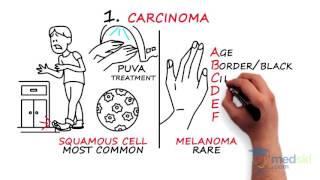 Dermatology  Nail Complaints By Lukasz Cygan DO and Abbas Husain MD [upl. by Abram455]