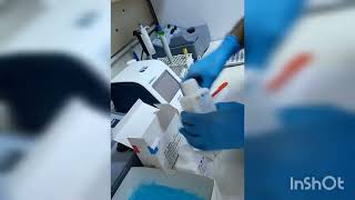 پشکنینی زەردوویی بەڕێگەی مانیۆلBilirubin TotalDirectampindirectjaundice [upl. by Ttesil257]