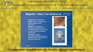 Compression Anastomosis for GastroJejunal Anastomosis [upl. by Zitah]