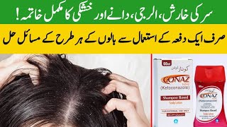 3 quick ways to stop hair fall and hair loss at home  anti hair fall shampoo  dandruff pewdiepie [upl. by Atwater]