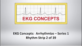 EKG Concepts Arrhythmias Course  Strip 2 of 39 [upl. by Menis]