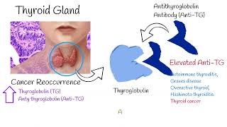 Thyroglobulin and Antithyroglobulin explained easy TG and Anti Tg TgAb tests [upl. by Riatsila]