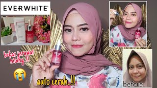 Review EVERWHITE Chromabright Brightening Serum di kulit sensitif New Packaging [upl. by Aneen]