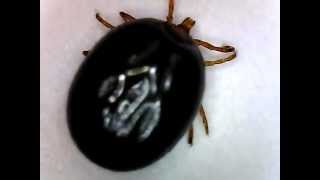 Engorged Tick Magnified [upl. by Airdnua]