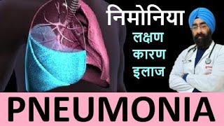 निमोनिया  What happens in Pneumonia  Symptoms amp Treatment  DrEducation Hindi  Eng subs [upl. by Frieda16]