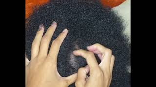 ASMR FAST AND AGGRESSIVE SCALP SCRATCHING VERRRRYY CRISPY ENJOY [upl. by Fretwell]