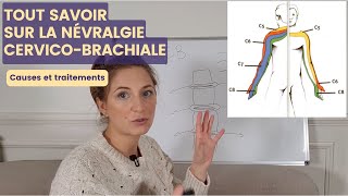 NÉVRALGIE CERVICOBRACHIALE  cause et symptômes pour mieux agir ensuite [upl. by Adrianne847]