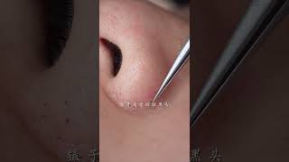 immersive skin care strawberry nose blackhead deep pore cleaning skin management [upl. by Adeehsar]