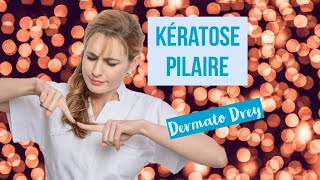 Kératose pilaire  boutons peau granuleuse poils incarnés comment se soigner  DermatoDrey [upl. by Laney]