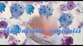 Gardnerella vaginalis [upl. by Emmie]