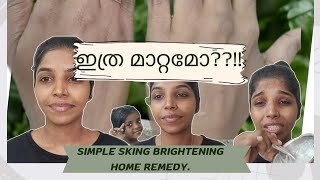 Skin Brightening Home remedyskincareskinbrighteningskinbrighteningfacepacskincaretipseasy [upl. by Adnoraj]