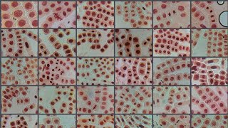 2 ACETICACETO ORCEIN STAINED ONION ROOT TIP CELL DIVISION STAGES [upl. by Chryste]