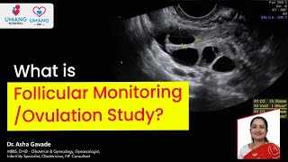 What is Follicular Monitoring Ovulation Study  Dr Asha Gavade  Umang Hospital  Pune [upl. by Naek52]