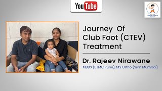 Journey of club foot CTEV Treatment  successfully treated by Dr Rajeev Nirawane [upl. by Greenwell]