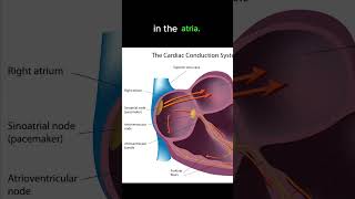 SVT ECG [upl. by Thackeray]