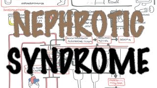 Nephrotic Syndrome  Overview Sign and symptoms pathophysiology [upl. by Htrow]