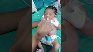 Cute baby feeding 😋nicu newbornbaby trending yrshorts shortsvideo viralshorts youtubeshorts [upl. by Simmons845]