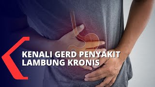 Awas Bisa Sebabkan Komplikasi Kenali Gerd Penyakit Lambung Kronis [upl. by Elocan34]