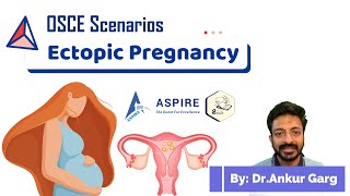 Ectopic pregnancy  OSCE Scenarios  Aspire Education  PLAB2 [upl. by Naek]