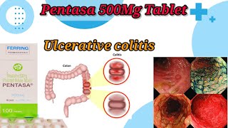 Pentasa 500Mg Tablet UseBenefitsSide EffectsUlcerative Colitis TreatmentFull Reviews [upl. by Quintina860]