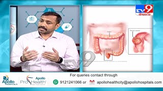 Episode 11  Colon amp Rectal Cancer  Dr Kishore Alapati Colorectal Surgeon  Apollo Aarogyamastu [upl. by Hussein]