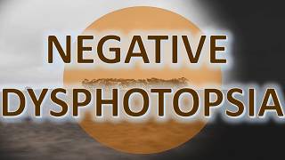 Negative Dysphotopsia  Management with the ND Ring [upl. by Marbut12]