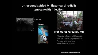 Ultrasound guided M flexor carpi radialis tenosynovitis injection by Prof Murat Karkucak MD [upl. by Theran783]