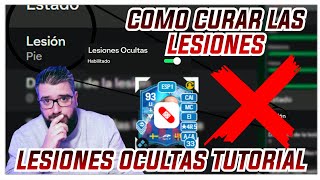 ❌COMO CURAR LESIONES OCULTAS TUTORIAL PALETOOLS PARA CURAR LAS LESIONES OCULTAS  HANDICAP FC 24 [upl. by Buschi]