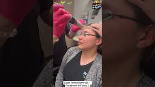 Ellies Eyebrow Laser ⚡️Tattoo Removal Journey Treatments s 46 at Las Vegas Dermatology® [upl. by Hoenack]