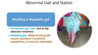 Motor System Examination Part12  Gait amp Station  CNS Examination  Pediatrics [upl. by Oner]