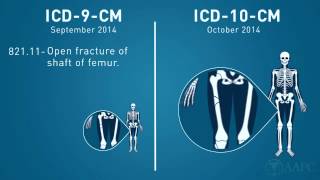 What is ICD10 [upl. by Nirmak]