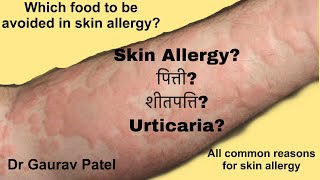 Skin allergy in hindi urticariaपित्ती शीतपत्ति causesfood and other allergen Dr Gaurav patel [upl. by Yanahc]