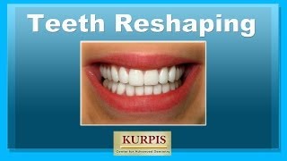 Teeth Reshaping [upl. by Yla]