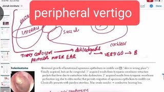 peripheral vertigo otorhinolaryngology 8  First Aid USMLE Step 1 in UrduHindi [upl. by Burchett]