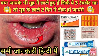 सिर्फ ये टेबलेट खा लो मुह के छाले 1 दिन मेें ठीक हो जायेंगे  Stomatitis Treatment in hindi  Ulcer [upl. by Kindig]