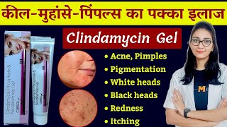 Clindamycin and Niacinamide gel uses benefits dose side effects  Clinsol gel  Clindamycin gel [upl. by Irehj]