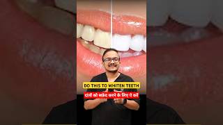 2 ways of teeth whitening suratdentist dentist smiledentist [upl. by Gerik]