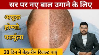 hair loss homeopathic medicine hair loss treatment in homeopathy [upl. by Enelegna950]