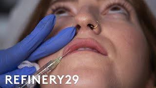 I Got Lip Filler Injections For The First Time  Macro Beauty  Refinery29 [upl. by Ahsla]