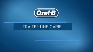 Comment soigner une carie dentaire [upl. by Nabal]